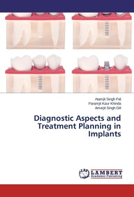 Diagnostic Aspects and Treatment Planning in Implants