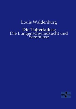 Die Tuberkulose