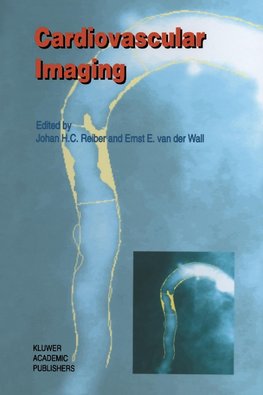 Cardiovascular Imaging