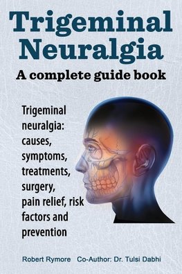 Trigeminal neuralgia