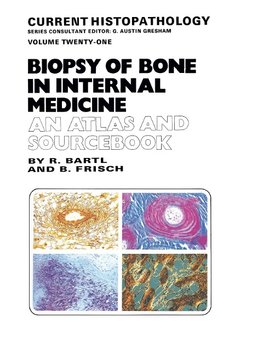 Biopsy of Bone in Internal Medicine: An Atlas and Sourcebook