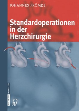 Standardoperationen in der Herzchirurgie