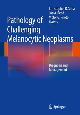 Pathology of Challenging Melanocytic Neoplasms