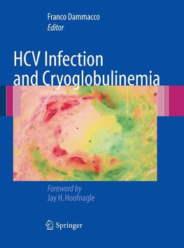 HCV Infection and Cryoglobulinemia