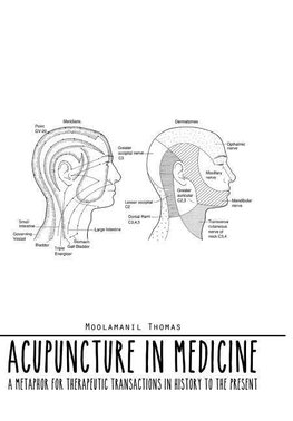 Acupuncture in Medicine