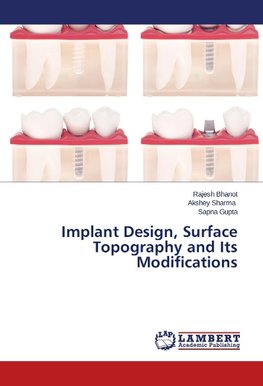 Implant Design, Surface Topography and Its Modifications