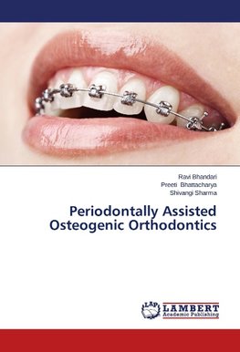 Periodontally Assisted Osteogenic Orthodontics