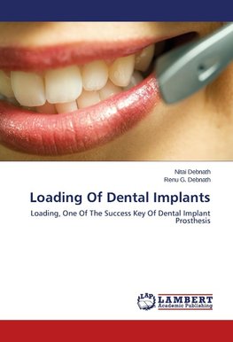 Loading Of Dental Implants