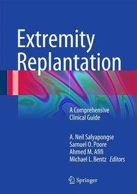 Extremity Replantation