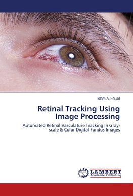 Retinal Tracking Using Image Processing