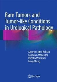 Rare Tumors and Tumor-like Conditions in Urological Pathology