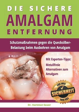 Die sichere Amalgam-Entfernung