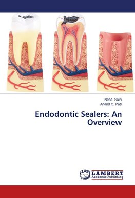 Endodontic Sealers: An Overview