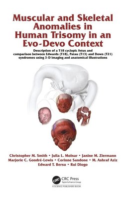 Muscular and Skeletal Anomalies in Human Trisomy in an Evo-Devo Context