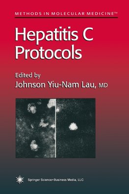 Hepatitis C Protocols