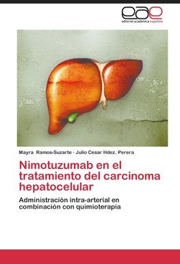 Nimotuzumab en el tratamiento del carcinoma hepatocelular