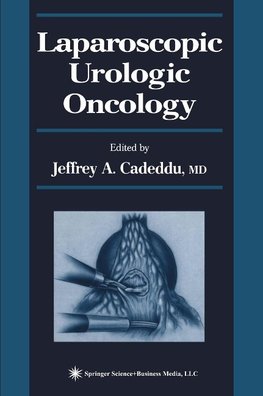 Laparoscopic Urologic Oncology