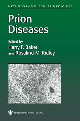 Prion Diseases