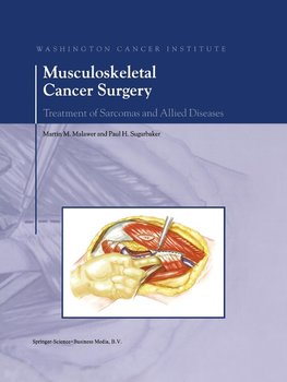 Musculoskeletal Cancer Surgery