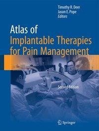 Atlas of Implantable Therapies for Pain Management