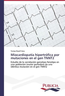 Miocardiopatía hipertrófica por mutaciones en el gen TNNT2