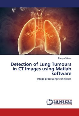 Detection of Lung Tumours in CT Images using Matlab software