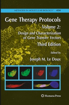 Gene Therapy Protocols