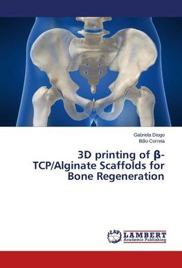 3D printing of ß-TCP/Alginate Scaffolds for Bone Regeneration