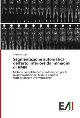 Segmentazione automatica dell'arto inferiore da immagini di RMN