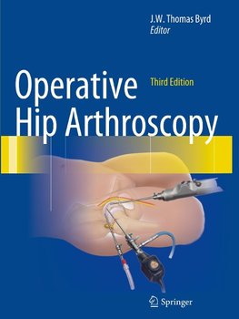 Operative Hip Arthroscopy