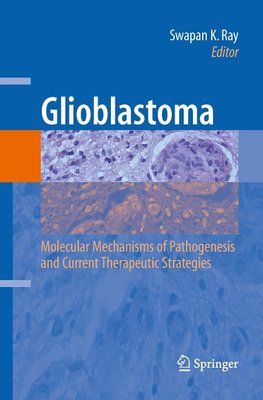 Glioblastoma: