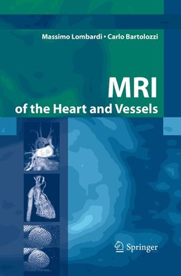 MRI of the Heart and Vessels