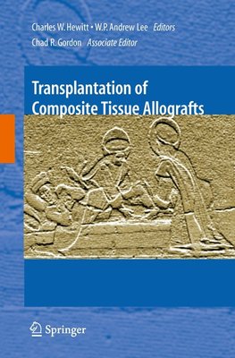 Transplantation of Composite Tissue Allografts