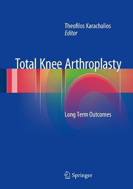 Total Knee Arthroplasty