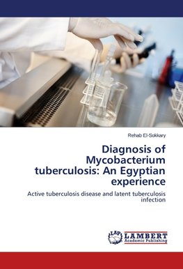 Diagnosis of Mycobacterium tuberculosis: An Egyptian experience