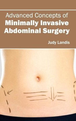 Advanced Concepts of Minimally Invasive Abdominal Surgery