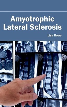 Amyotrophic Lateral Sclerosis