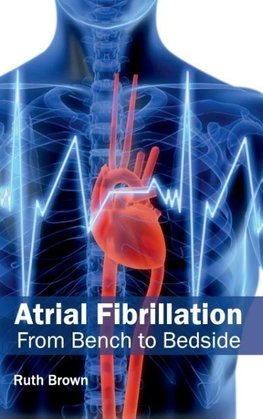 Atrial Fibrillation