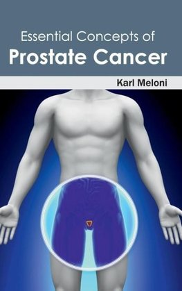 Essential Concepts of Prostate Cancer