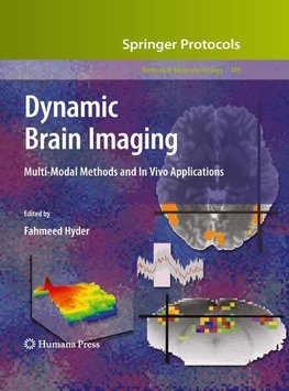 Dynamic Brain Imaging