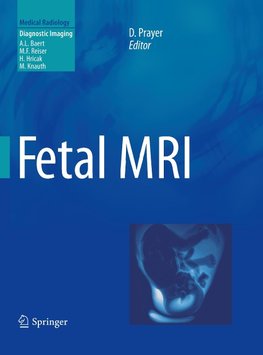 Fetal MRI