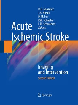 Acute Ischemic Stroke