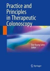 Practice and Principles in Therapeutic Colonoscopy