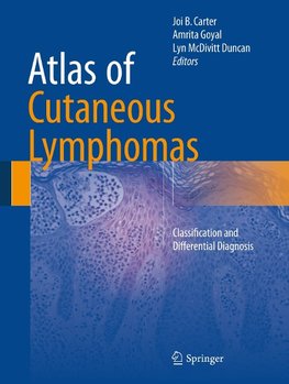 Atlas of Cutaneous Lymphoma