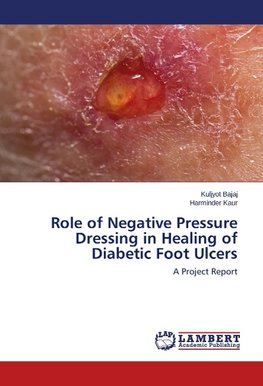 Role of Negative Pressure Dressing in Healing of Diabetic Foot Ulcers