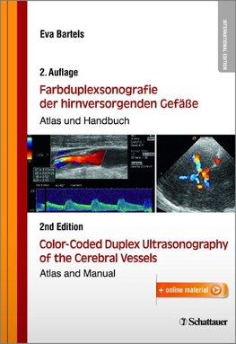 Farbduplexsonografie der hirnversorgenden Gefäße / Color-Coded Duplex Ultrasonography of the Cerebral Vessels