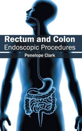 Rectum and Colon