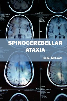 Spinocerebellar Ataxia