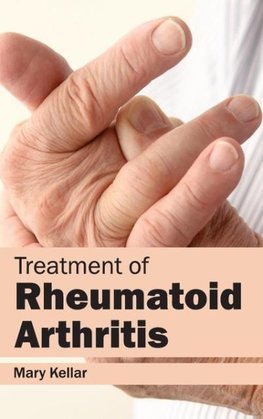 Treatment of Rheumatoid Arthritis