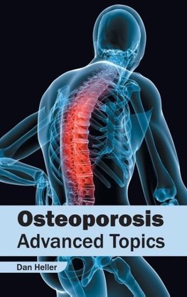 Osteoporosis